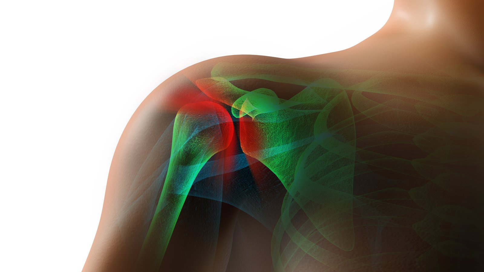 shoulder in pain. with rotator cuff